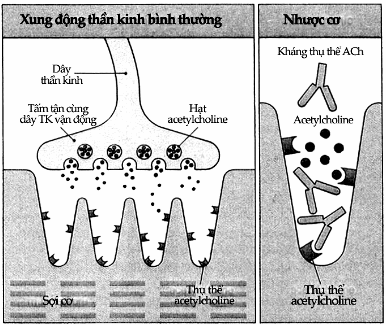 Đánh giá nồng độ tự kháng thể kháng thụ cảm thể acetylcholine ở bệnh  nhân nhược cơ